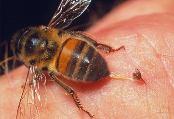 Saniranje uboda pčela i stršljenova